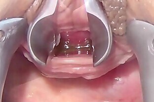 Masturbate Peehole with Toothbrush and Chain into Urethra